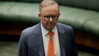 anthony albanese