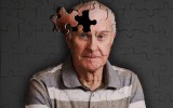 Alzheimer's