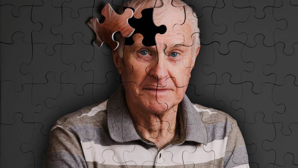 Alzheimer's